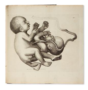 MEDICINE  WALTER, JOHANN GOTTLIEB. Observationes anatomicae. Historia monstri bicorporis, duobus capitibus, tribus pedibus [etc.]. 1775